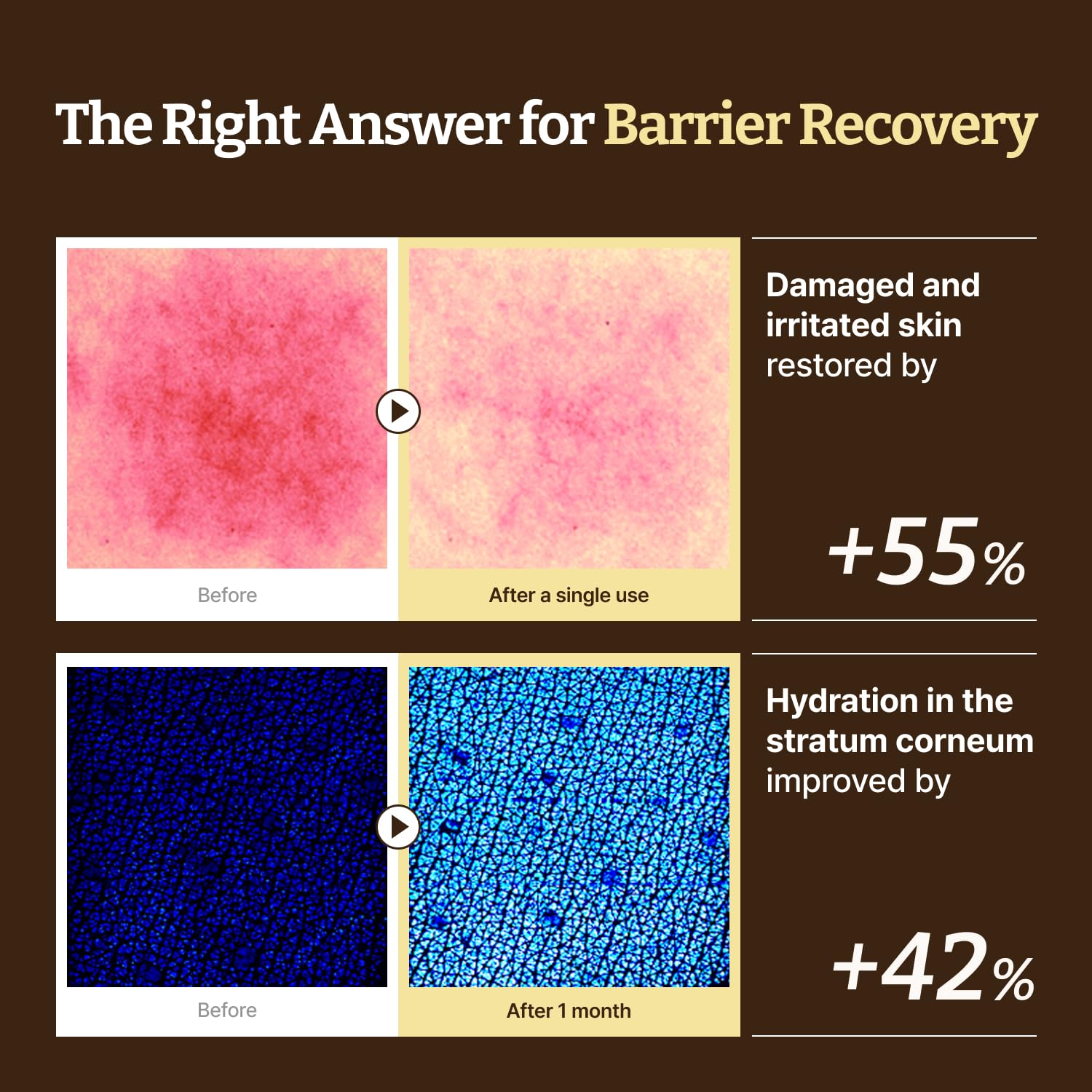 Advanced LC-Ceramide Barrier Cream