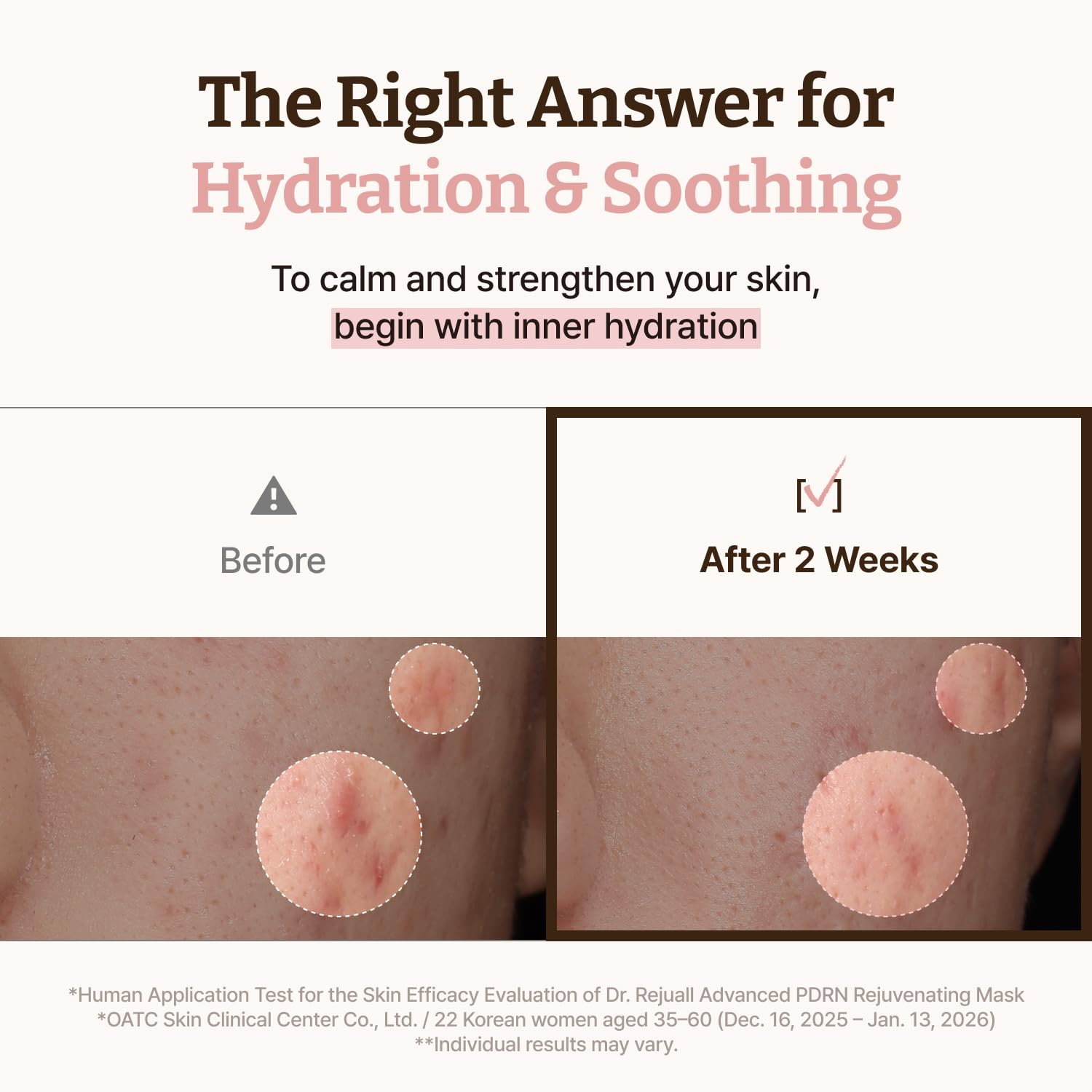 Advanced PDRN Rejuvenating Mask