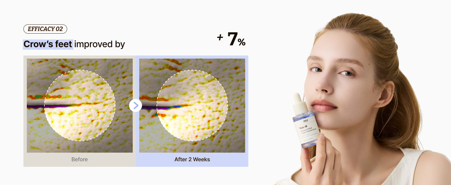 slider image slider_item_8H3Vat