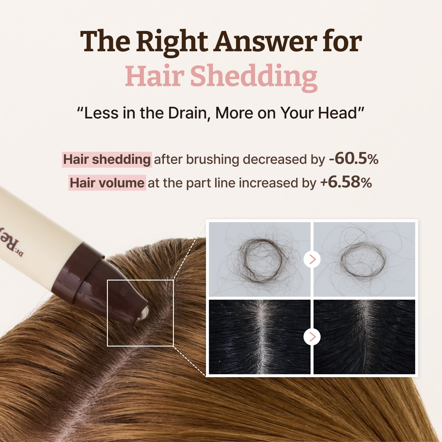 Advanced PDRN Hair Density Scalp Serum