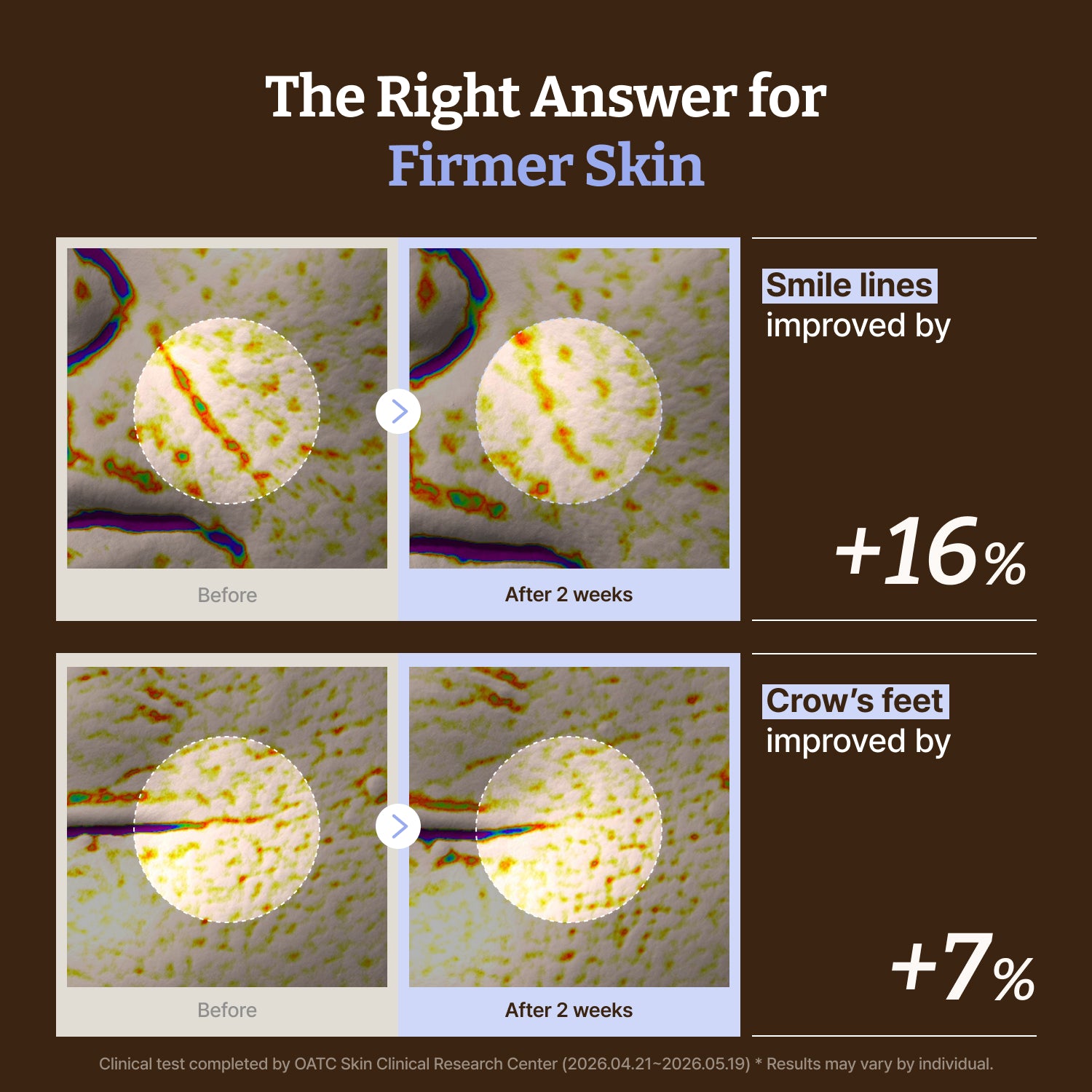 The Curated Essentials Bundle: PDRN Copper Peptide Serum + PDRN Cream + LC-Ceramide Barrier Cream + PDRN Mask